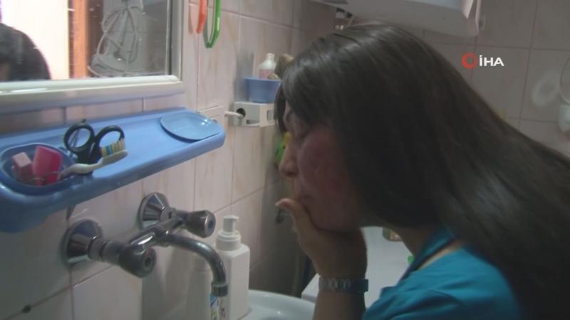 Yıllara sonra suyla barıştı, güneşle barışamadı.