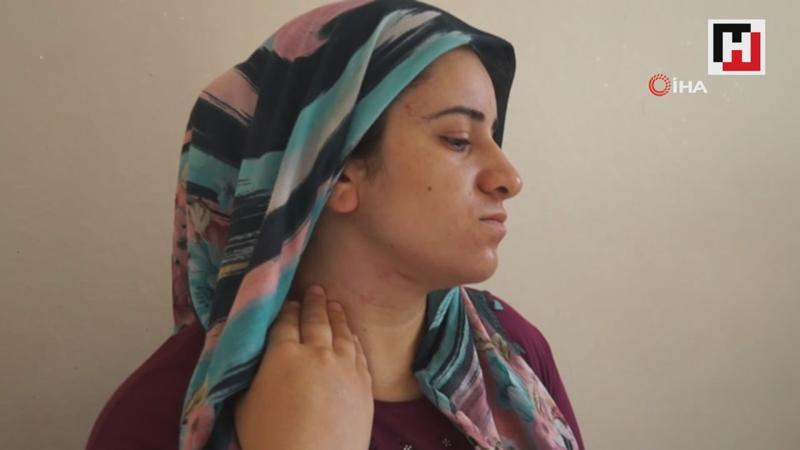 Babasından kalan mirası reddeden 8 aylık hamile kadına darp