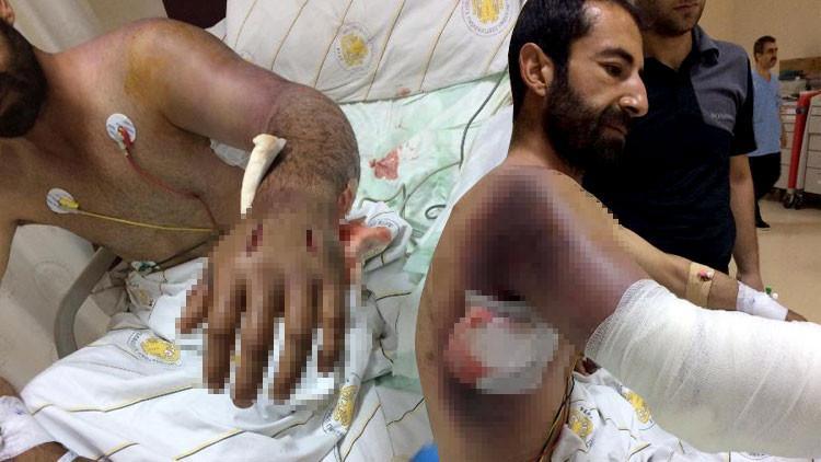 DiyarbakÄ±r'da korkunÃ§ olay! YÄ±lan bu hale getirdi...