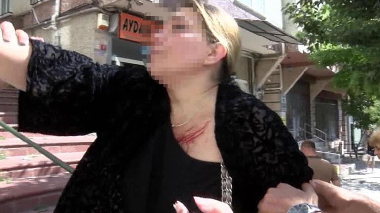 Şişlide eşiyle kavga eden yaralı kadın gazetecilere tepki gösterdi