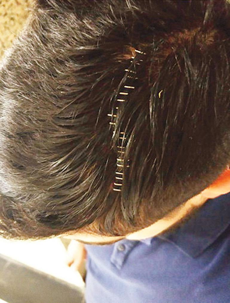 BalÄ±kÃ§Ä± dayaÄÄ±... 20 kiÅi saldÄ±rdÄ± 25 dikiÅ atÄ±ldÄ±